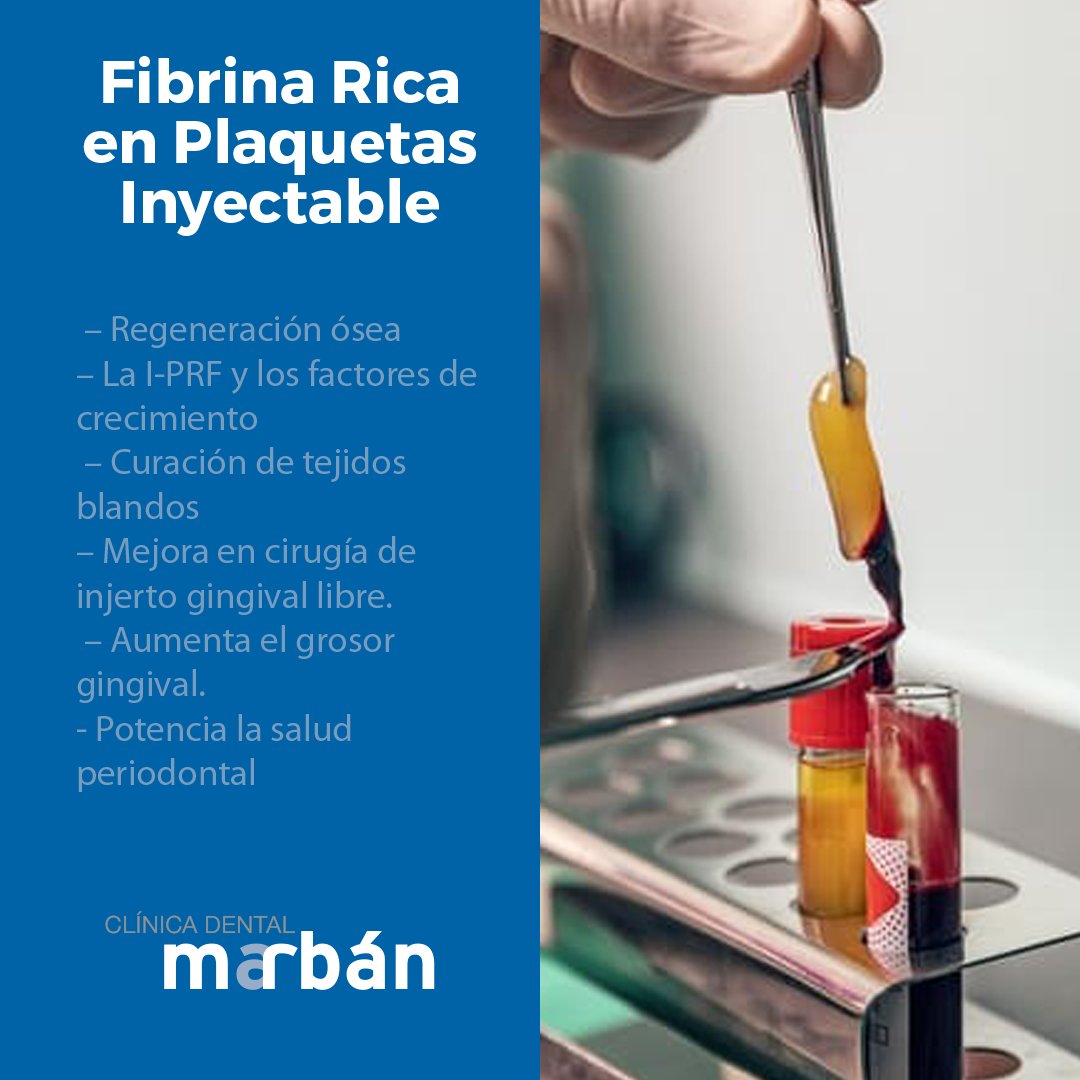 ¿Qué es y cómo actuar la Fibrina Rica en Plaquetas Inyectable en la regeneración periodontal?
Te lo contamos vía #Gacetadental 👉 bit.ly/3qvBFVx
#ClinicaDentalMarban #plaquetas
