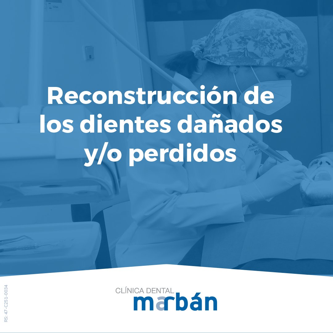 La rehabilitación dental es la reconstrucción de los dientes dañados y/o perdidos para lograr el óptimo funcionamiento del #masticado y mejorar la fonética y la #estéticadental 
Cuida tu salud, cuida tus dientes y Vive sonriendo💙
bit.ly/3eGVqXs

#ClinicaMarban #dentista
