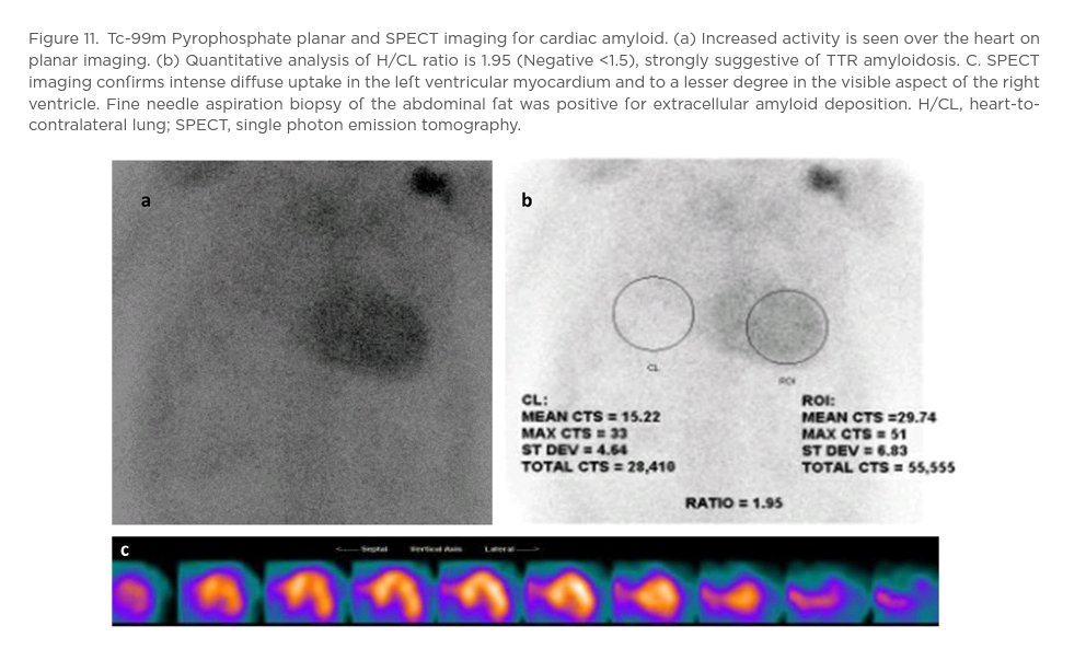 rabenlabga's tweet photo. #amyloidosis https://t.co/RxEzgZwV4s