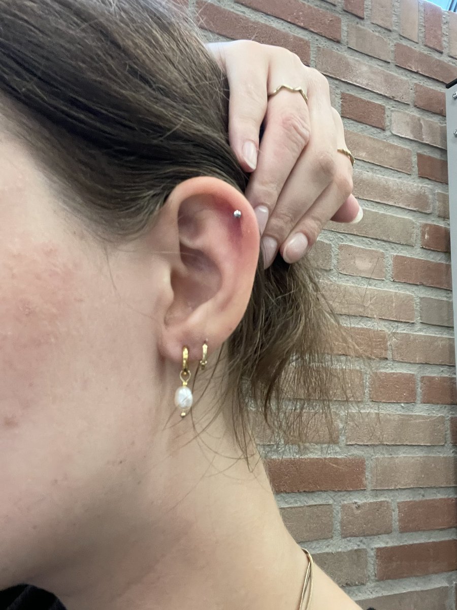 tvmeals's tweet photo. my ear has become so swollen https://t.co/vAjqlyPYFk