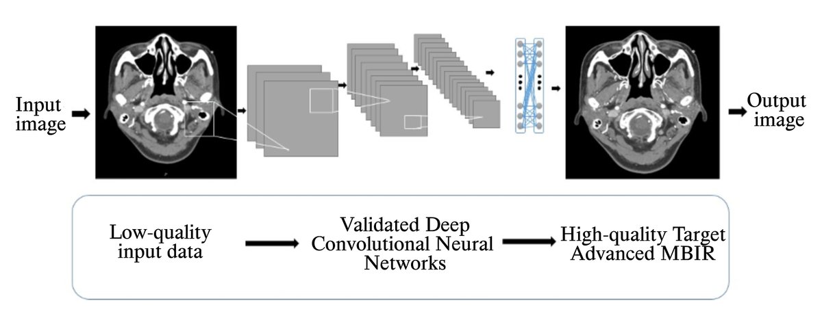 JINeuroscience's tweet image. #2021Issue4
The #DeepLearningReconstruction method generally improves the image quality of brain computed tomography angiography in terms of objective measurement and subjective grading
imrpress.com/journal/JIN/20…
#ComputedTomography #CT #imaging #BrainAngiography #IntracranialVesse
