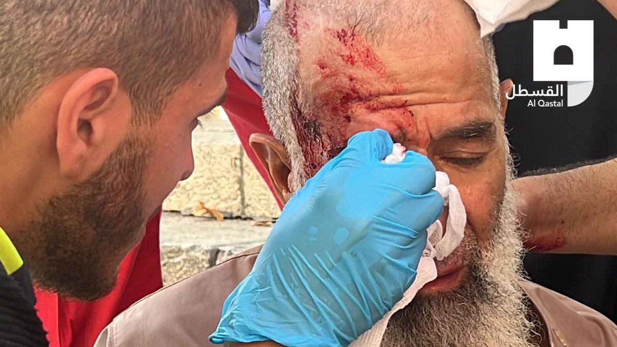 Pictures: the Palestinian elderly man who was brutally assaulted by the lsraeli occupation forces near Al-Aqsa mosque.