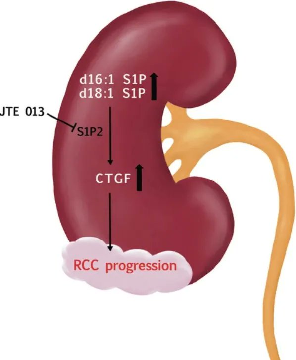 FEBSJournal's tweet photo. 📒The atypical sphingosine 1-phosphate variant, d16:1 S1P, mediates CTGF induction via S1P2 activation in renal cell carcinoma 

🖊️ By Rajkumar Vutukuri and team from @goetheuni 
🔗 https://t.co/Hstq63py2K 

#CTGF #RCC #S1Preceptors https://t.co/Li0iONuX2O