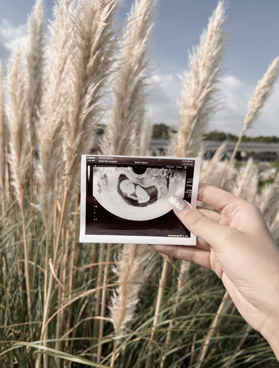 yr820_p's tweet photo. 👶🏼🌾 https://t.co/vSI42FU1xD