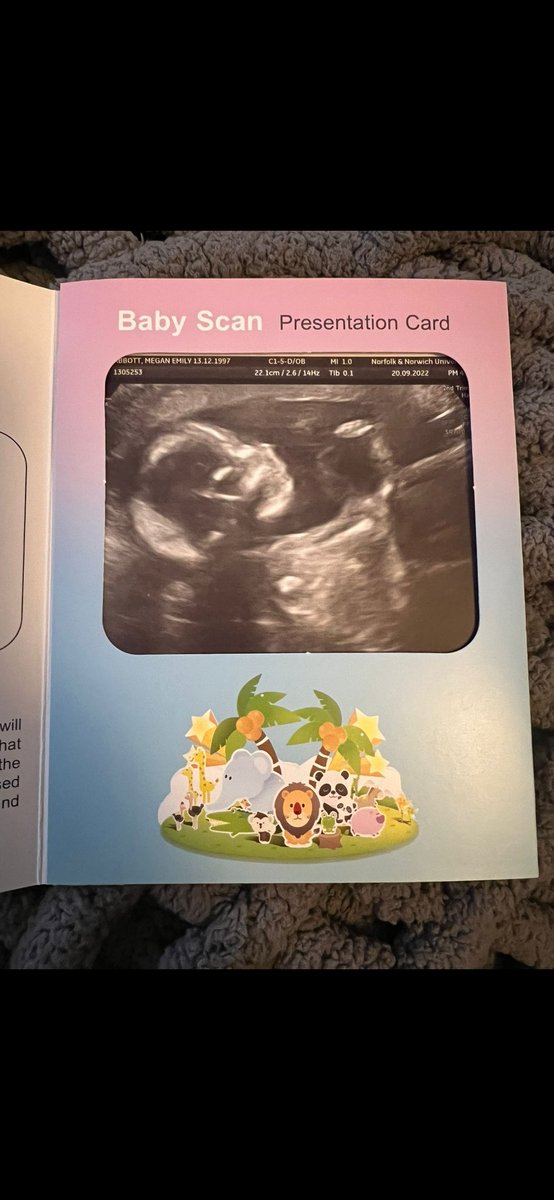 Megan_ems_'s tweet photo. 17 more weeks until we get to meet you- you are so loved already my boy 🤍 https://t.co/vWGzKtjLp1