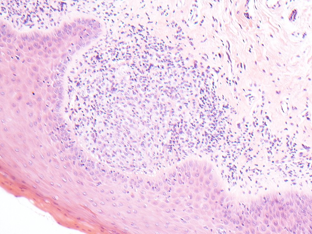 Oral Path Opinion tweet media