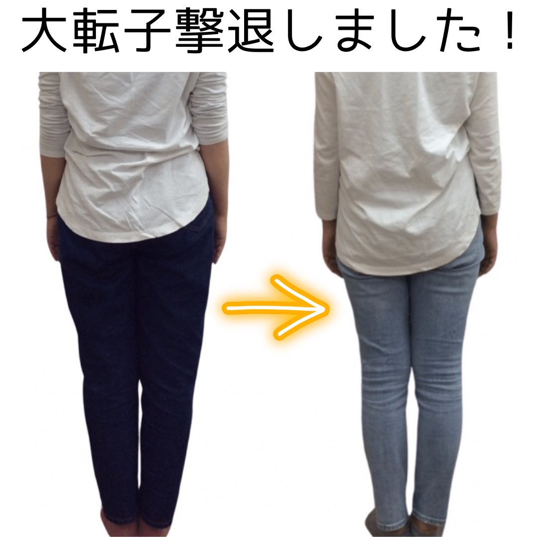 大転子矯正 Twitter Search Twitter