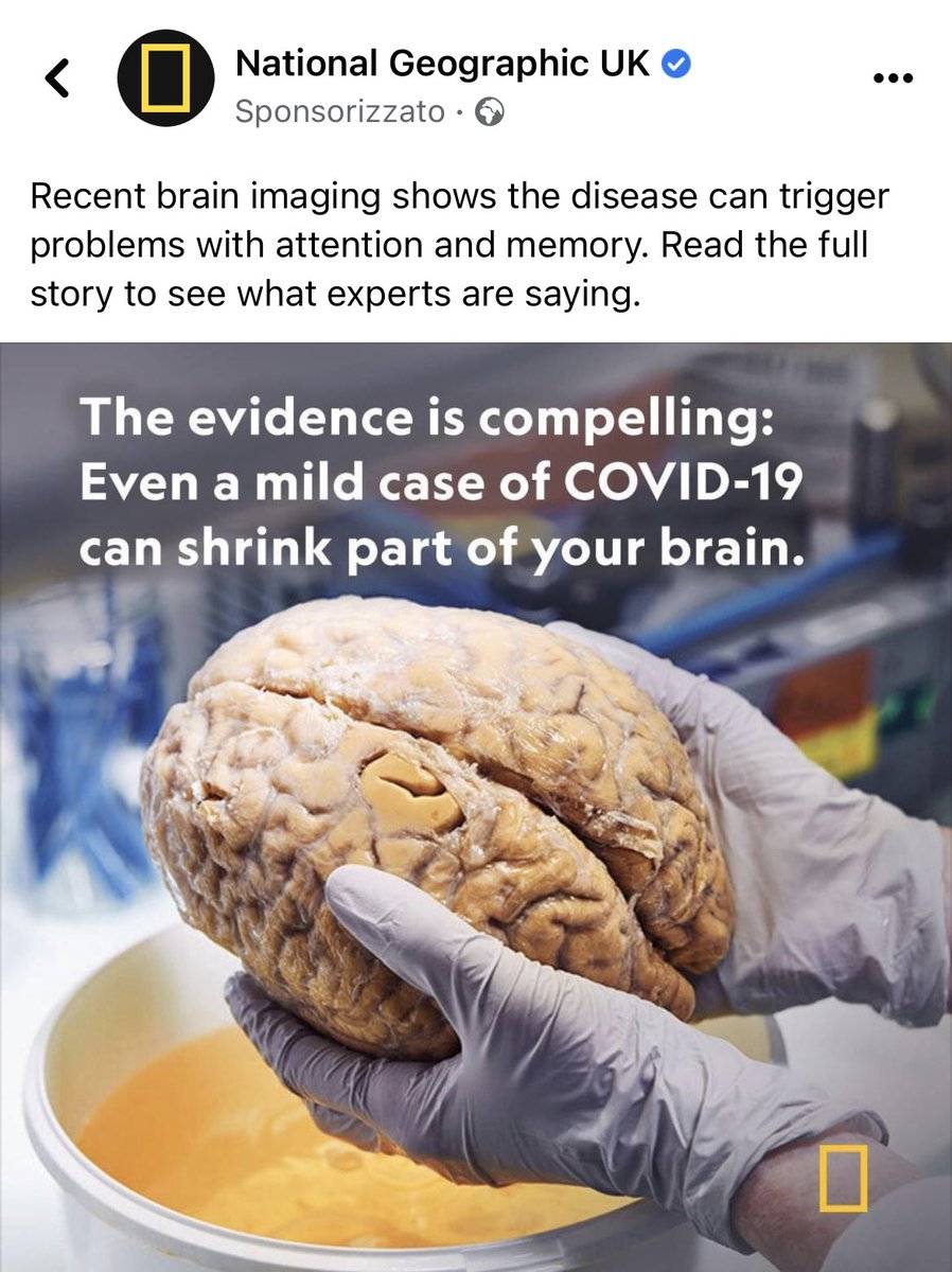 Atipico1996's tweet photo. What did I just see?!

A reliable source such as the National Geographic is confirming that COVID infection can damage the brain. This is the worst possible outcome for society. https://t.co/GcMkyhQAh4