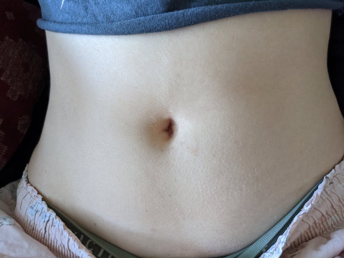 Sick again 😐 https://t.co/4997g3u1G6<a href="/tag/redhead"class="tags"><span>#redhead</span></a><a href="/tag/hips"class="tags"><span>#hips</span></a><a href="/tag/belly"class="tags"><span>#belly</span></a>