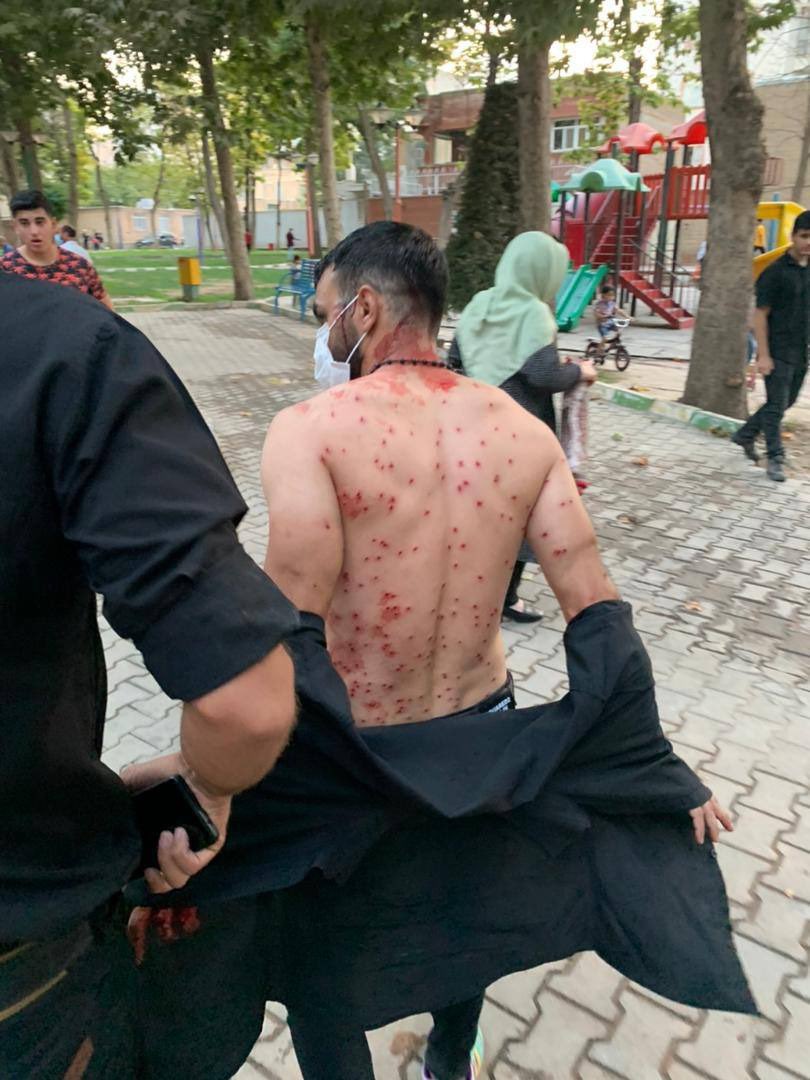 Beneath this mask is more than flesh. Beneath this mask is an idea, and ideas are bulletproof..

#MahsaAmini
#مهسا_امینی
#اشنویه
#OpIran