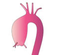 BAVTAD's tweet photo. September Awareness 2022 - Breaking the Pattern of Sudden Death https://t.co/YVrHLKtI5B #BAVTAD #CAD #suddendeath https://t.co/Me2ewROdPD