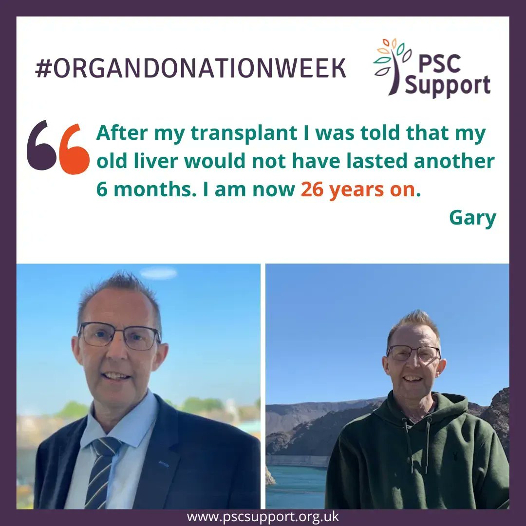 PSC Support (@pscsupportuk) on Twitter photo "After my transplant I was told that my old liver would not have lasted another 6 months. I am now 26 years on."
In #OrganDonationWeek, Gary tells us his story <a href="/leeds_liver/">Leeds Liver Transplant and Hepatology</a> 🙏 👉buff.ly/3SAiEgM
<a href="/NHSOrganDonor/">NHS Organ Donation💗🫀🫁</a> <a href="/share_wishes/">Share Your Wishes</a> #GiftOfLife "After my transplant I was told that my old liver would not have lasted another 6 months. I am now 26 years on."
In #OrganDonationWeek, Gary tells us his story <a href="/leeds_liver/">Leeds Liver Transplant and Hepatology</a> 🙏 👉buff.ly/3SAiEgM
<a href="/NHSOrganDonor/">NHS Organ Donation💗🫀🫁</a> <a href="/share_wishes/">Share Your Wishes</a> #GiftOfLife