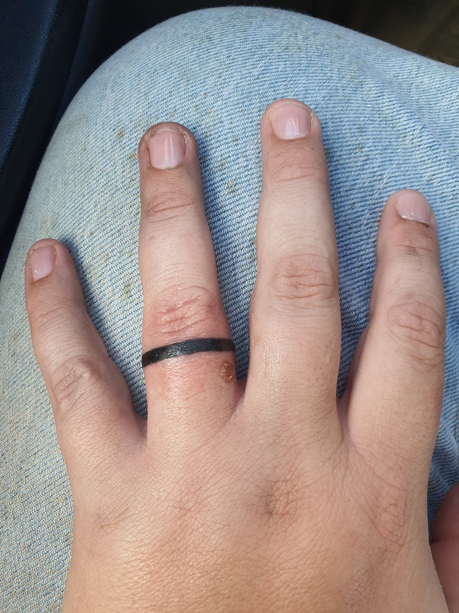 kate_jewett's tweet photo. How to make sure you never lose your wedding ring, option 1:
#JustMarried #FirstTattoo #CrazyWeekend https://t.co/JNgNdwnesY