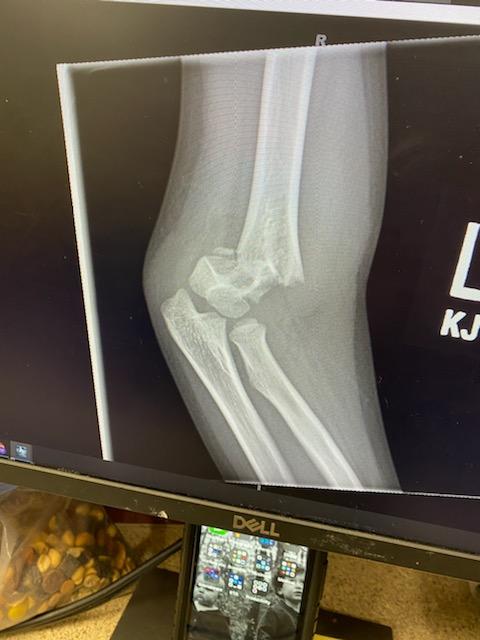 keonwife's tweet photo. @chatsandbets I definitely need this blessing, my son broke his arm and and Dr.Appts are costly https://t.co/Y7EsuUwzDv
