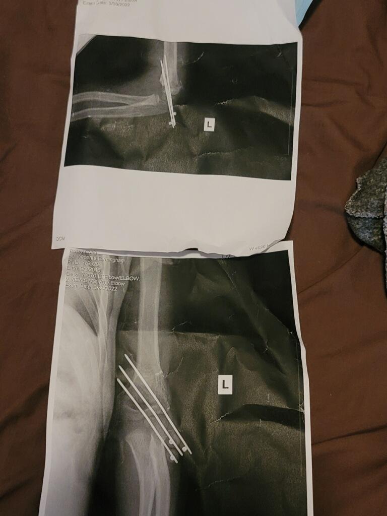 keonwife's tweet photo. @chatsandbets I definitely need this blessing, my son broke his arm and and Dr.Appts are costly https://t.co/Y7EsuUwzDv