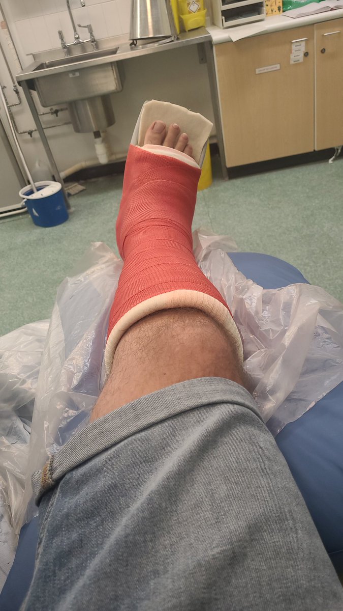 Ce4186's tweet photo. Not the news I wanted. Put Into plaster and a second scan has found some clotts in the calf. #upthereds #lfc #LFCGear #tornachillies https://t.co/q2yoCQsH7K