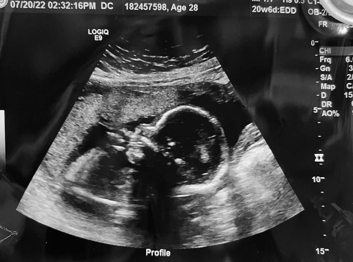 10 more weeks and baby boy will be here 💙 #excited