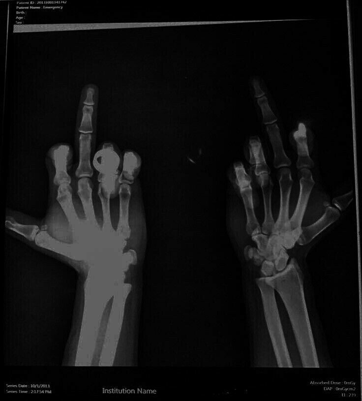 jungxess's tweet photo. ¿Qué hago para bajar un kilo por día?
Un hilo para edtwt o algo así pq les puede servir.
#edtwthread #edtwtdiet #edtwt https://t.co/q1IHC4AqHw