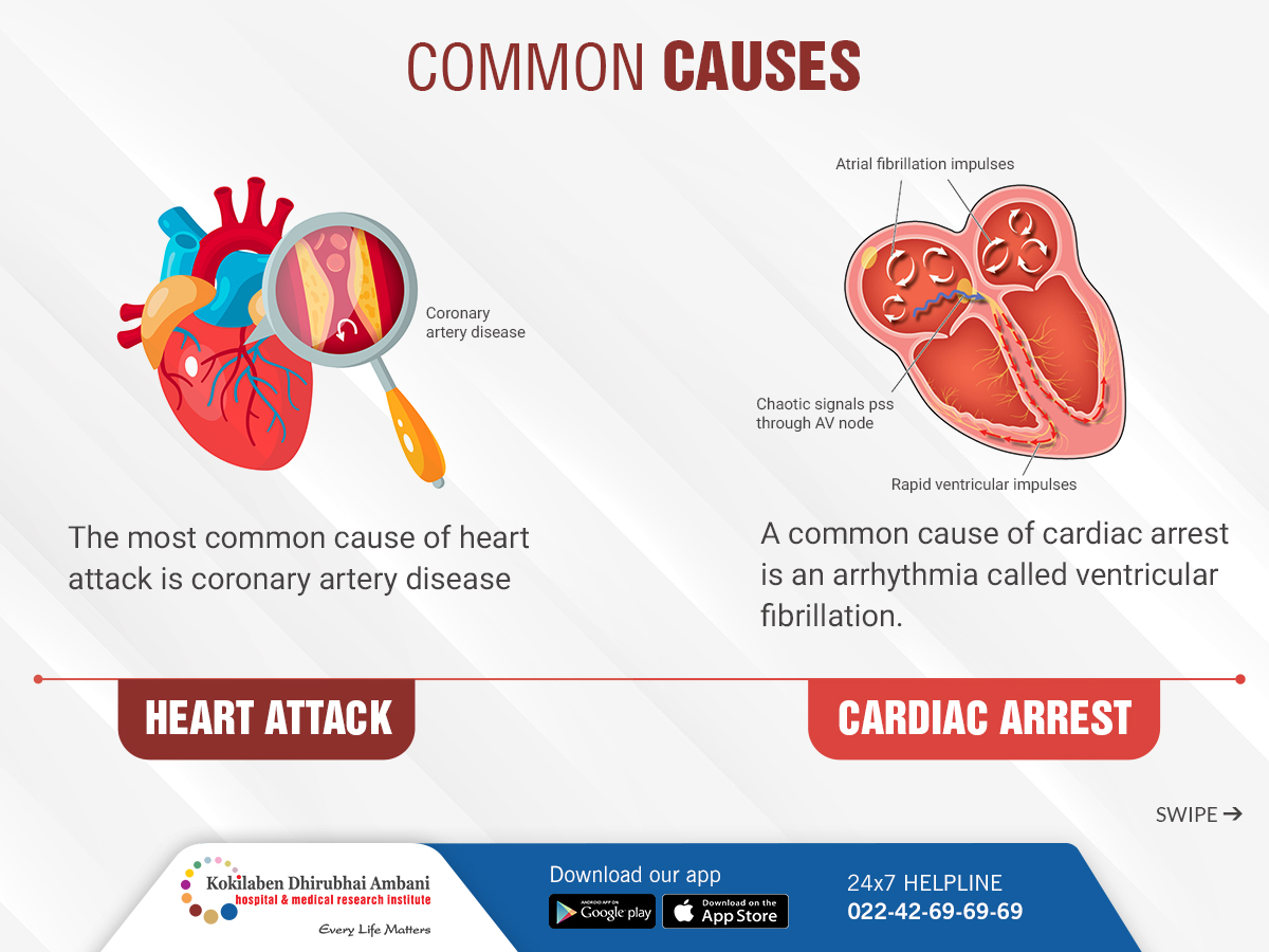 World Heart Day: Difference between cardiac arrest, heart attack, heart  failure