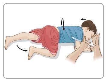 DoktorSamhan's tweet photo. “Hello bro, nak buat macam mana ni?”

Sejurus aku angkat panggilan dari kawanku,terus ditanya sebegini. Kedengaran suaranya cemas.

“Relax bro, nak buat apa ni? Aku tak paham”

“Anak aku sawan ini. Mata terbeliak keatas, tangan kaki semua tertarik kejang. Aku masukkan sudu dalam https://t.co/RbZbsHSvlN
