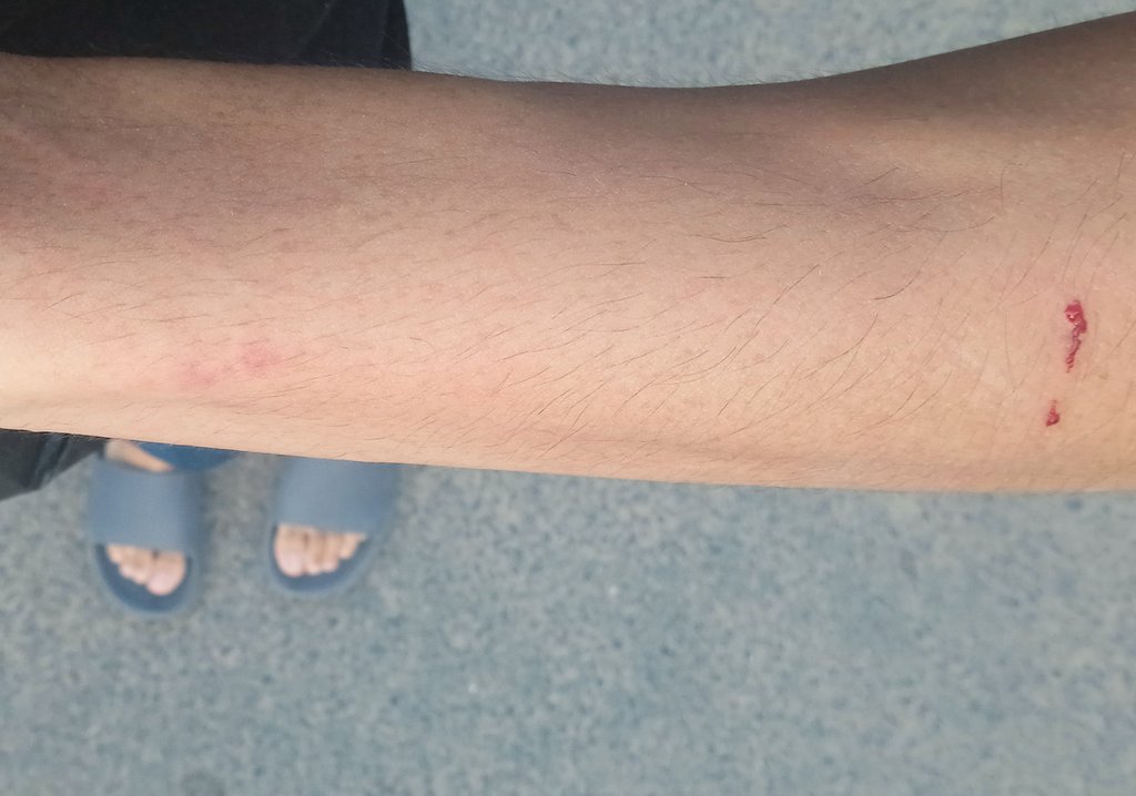 ShannyMurry's tweet photo. This morning my mom bite me
Discipline or Abuse ?
#quora #TrustOfIndia #r4today #sensative #twitch https://t.co/7VfvQgSYn3