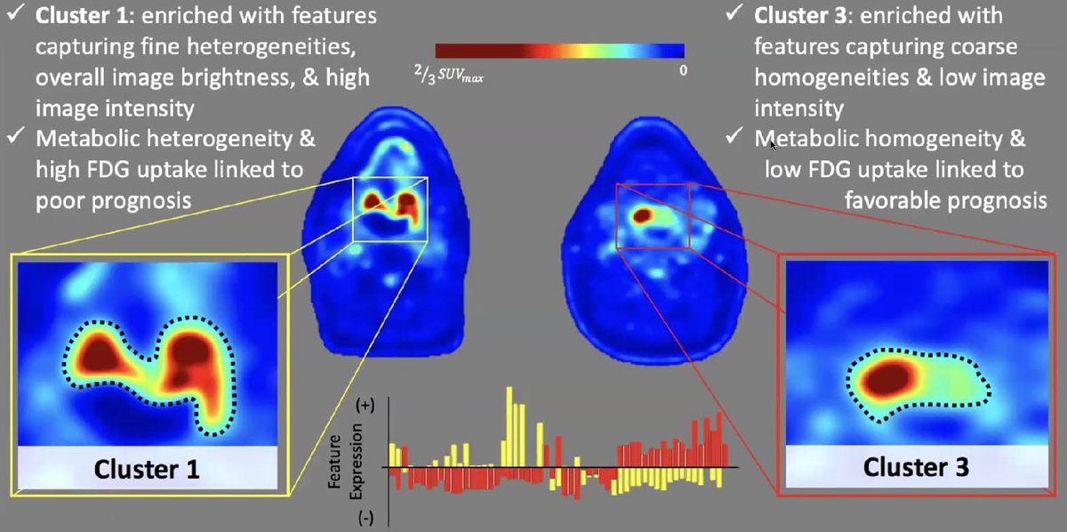TheSIAMNews's tweet photo. At #SIAMMDS22, @KyleLafata of @DukeU introduced novel #data-driven strategies that model head and neck #cancers across space and time. Specifically, he examined the way in which #tumors change #morphologically and #metabolically in response to treatment. https://t.co/CW2W3XjZdz https://t.co/be4aVr2uIm