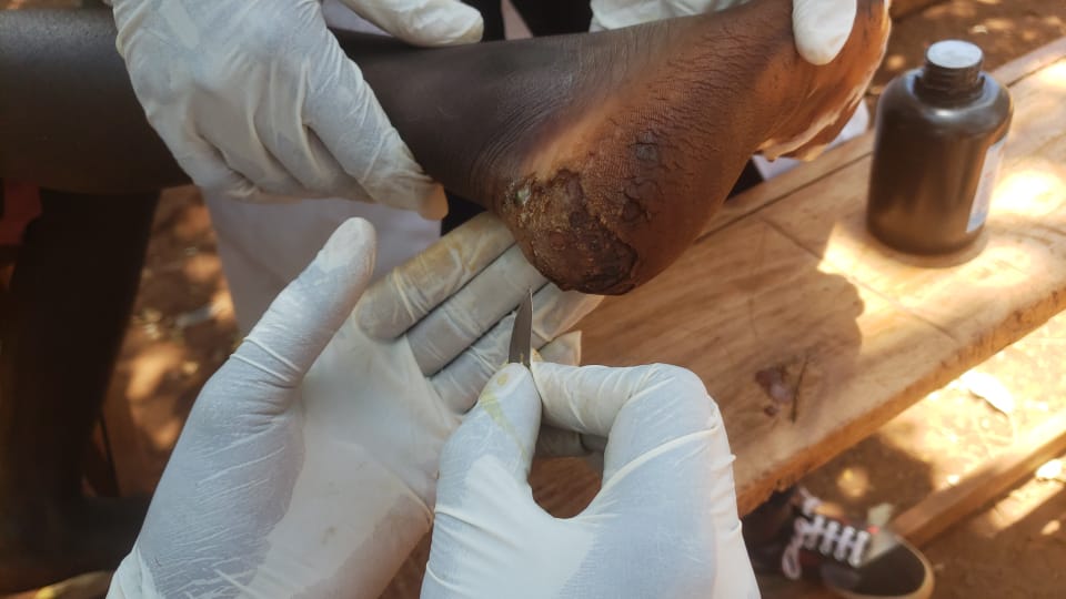 PeaceAmbsKenya's tweet photo. Anti-jiggers campaign at Lugari ward; covered 6 villages,220 households were fumigated and 311 families were treated. Special appreciation to  PAK MMUST chapter, PAK KMTC Kakamega, Lugari and Shianda, @stjohnambulance for volunteering in this project.
 @MOH_Kenya @KenyaRedCross https://t.co/PcjrttrAms
