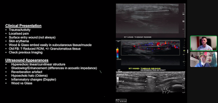 The Ultrasound Site - MSK ultrasound training (@mskultrasound) on Twitter photo Last night we were lucky enough to have a fantastic webinar with <a href="/Cronin90Kevin/">Kevin Cronin</a> and <a href="/JingaJohnny/">Johnny Walker</a> - thanks to all those who joined - over 100 at one point! The recording will be released over the next few days at theultrasoundsite.co.uk thanks guys! Last night we were lucky enough to have a fantastic webinar with <a href="/Cronin90Kevin/">Kevin Cronin</a> and <a href="/JingaJohnny/">Johnny Walker</a> - thanks to all those who joined - over 100 at one point! The recording will be released over the next few days at theultrasoundsite.co.uk thanks guys!