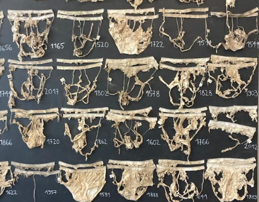 van der Heijden Lab (@vandeheijdenlab) on Twitter photo Last year we buried over 2000 pieces of underwear and 12000 teabags with 1000 volunteers to estimate soil health. This Wednesday first results will be presented. We found thousands of microbial taxa and results point to the importance of land use and soil carbon. <a href="/SFranzBender1/">S. Franz Bender</a> Last year we buried over 2000 pieces of underwear and 12000 teabags with 1000 volunteers to estimate soil health. This Wednesday first results will be presented. We found thousands of microbial taxa and results point to the importance of land use and soil carbon. <a href="/SFranzBender1/">S. Franz Bender</a>