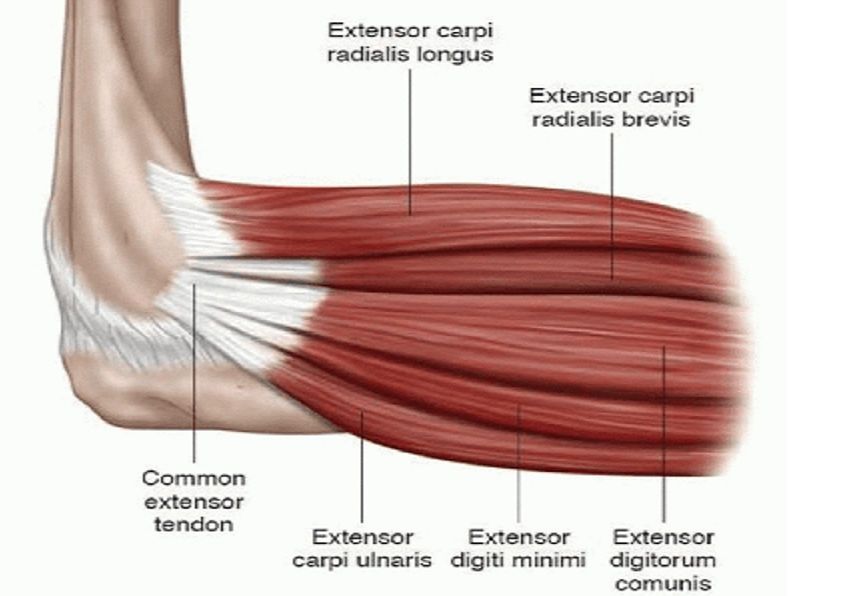 drdozellodc's tweet photo. Two Minutes of Anatomy: Posterior Forearm Muscles
Dr Donald A Ozello 
#chiropractor #chiropractic #sportsmedicine #anatomy #forearmmuscles #forearm #wristextensors #wristextension #commonextensortendon #tenniselbow #lateralepicondylitis #lateralepicondyle https://t.co/zW4m7g7xdX https://t.co/ucJ89nMe2g