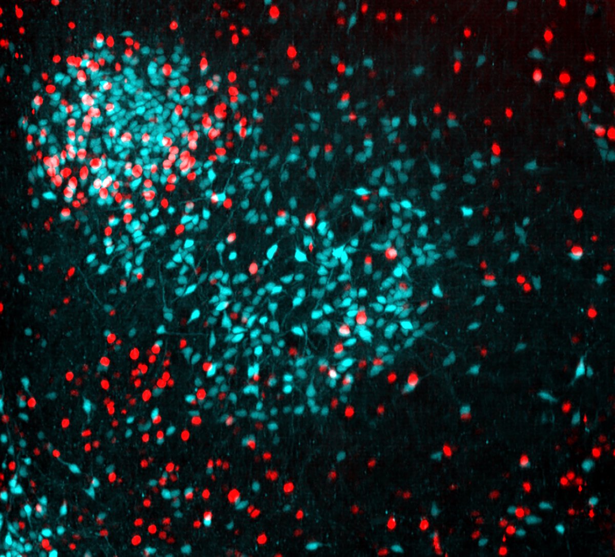 What if I told you this image was captured in a whole, intact brain using a 4x objective on a light sheet microscope? #lightsheet #microscopy #imaging #neurotwitter #Science
