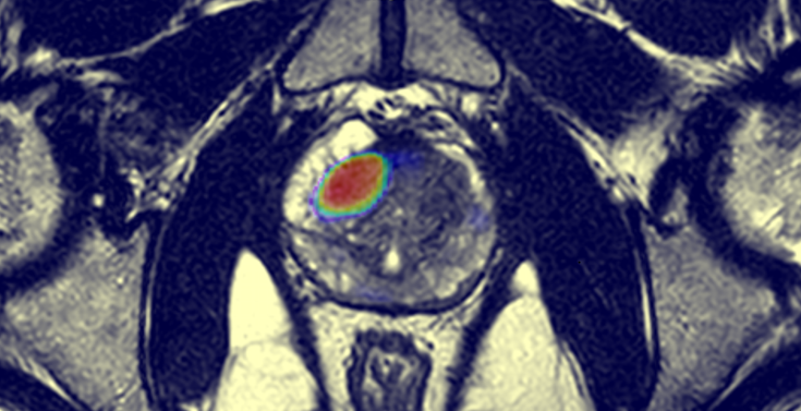 Baris Turkbey MD tweet media