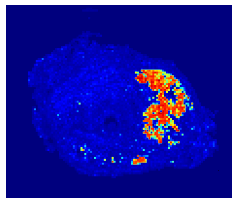 Baris Turkbey MD tweet media