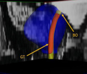 Baris Turkbey MD tweet media