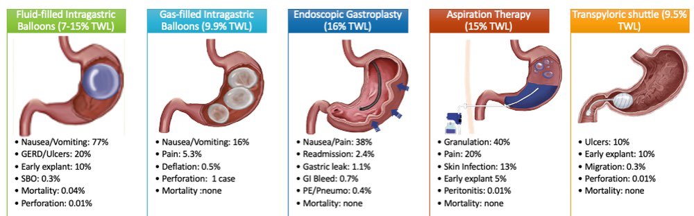 Erik Holzwanger, MD, ABOM-D (@hilarholzy) on Twitter photo @SigridSYoung in a critical review of options in treating patients who deal with metabolic disorders with the increasing 🌎 incidence
👀 <a href="/PopovVioleta/">Violeta Popov, MD PhD</a> experience in setting up an endoscopic bariatrics program <a href="/DeptVetAffairs/">Veterans Affairs</a> <a href="/nyulangone/">NYU Langone Health</a>
#GITwitter #MedEd
mdedge.com/gihepnews/arti… @SigridSYoung in a critical review of options in treating patients who deal with metabolic disorders with the increasing 🌎 incidence
👀 <a href="/PopovVioleta/">Violeta Popov, MD PhD</a> experience in setting up an endoscopic bariatrics program <a href="/DeptVetAffairs/">Veterans Affairs</a> <a href="/nyulangone/">NYU Langone Health</a>
#GITwitter #MedEd
mdedge.com/gihepnews/arti…