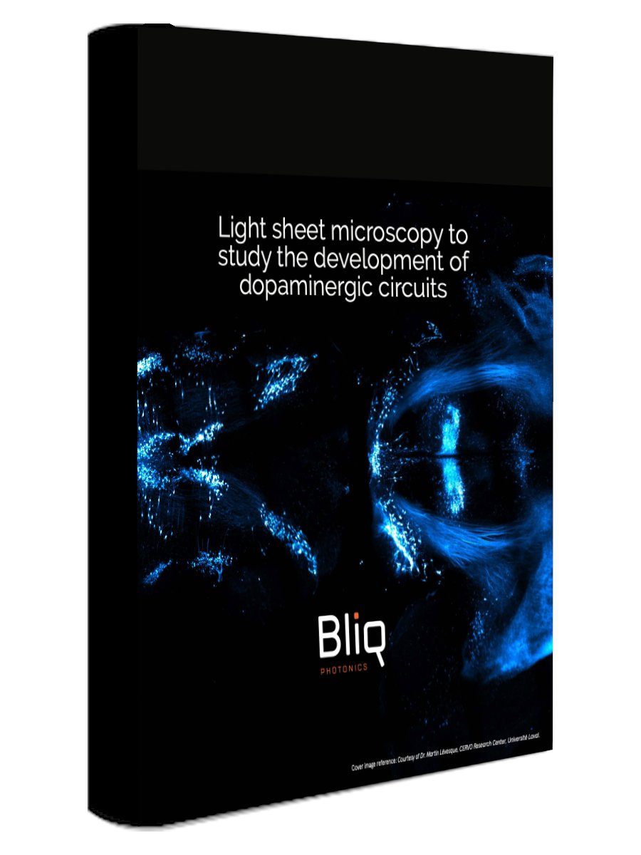 The laboratory of Martin Lévesque at the CERVO Research Center has chosen to benefit from the advantages of Bliq’s Bessel #lightsheet system in their exploration of #mousedopaminergic circuit development from embryonic to adult stages 🐁

NEW case study 👉 buff.ly/3BP3vkX