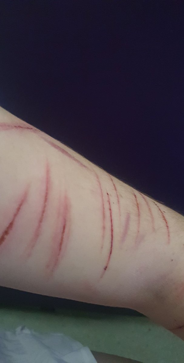 proshtwt's tweet photo. FAKE SFS!!!

These are feom last week to a month ago. Imma do it again soon and it will be better. It has to be #TWT #shtwt #scarstwt #catscratchestwt #madeofbeanstwt #beanstalk https://t.co/D3nZSSGGL9