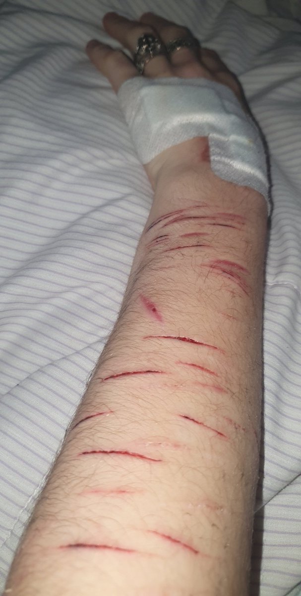 proshtwt's tweet photo. FAKE SFS MAKEUP!!!

I really wish I could go deeper. I have older ones that are deep but they still heal so quickly :/ #shtwt #madeofbeanstwt #rasberryfillingtwt #scratchtwt https://t.co/uvI9TctLCB