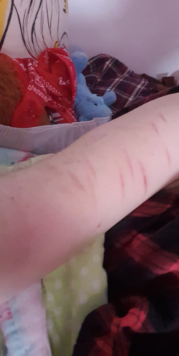 proshtwt's tweet photo. FAKE SFS MAKEUP!!!

I really wish I could go deeper. I have older ones that are deep but they still heal so quickly :/ #shtwt #madeofbeanstwt #rasberryfillingtwt #scratchtwt https://t.co/uvI9TctLCB