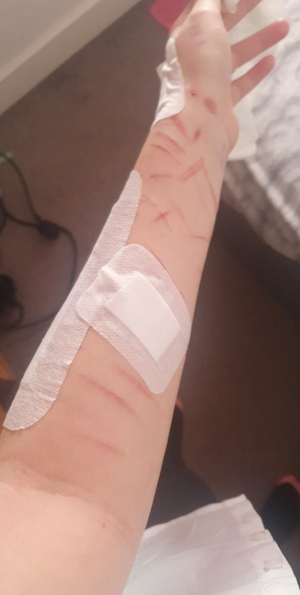 proshtwt's tweet photo. FAKE SFS MAKEUP!!!

I really wish I could go deeper. I have older ones that are deep but they still heal so quickly :/ #shtwt #madeofbeanstwt #rasberryfillingtwt #scratchtwt https://t.co/uvI9TctLCB
