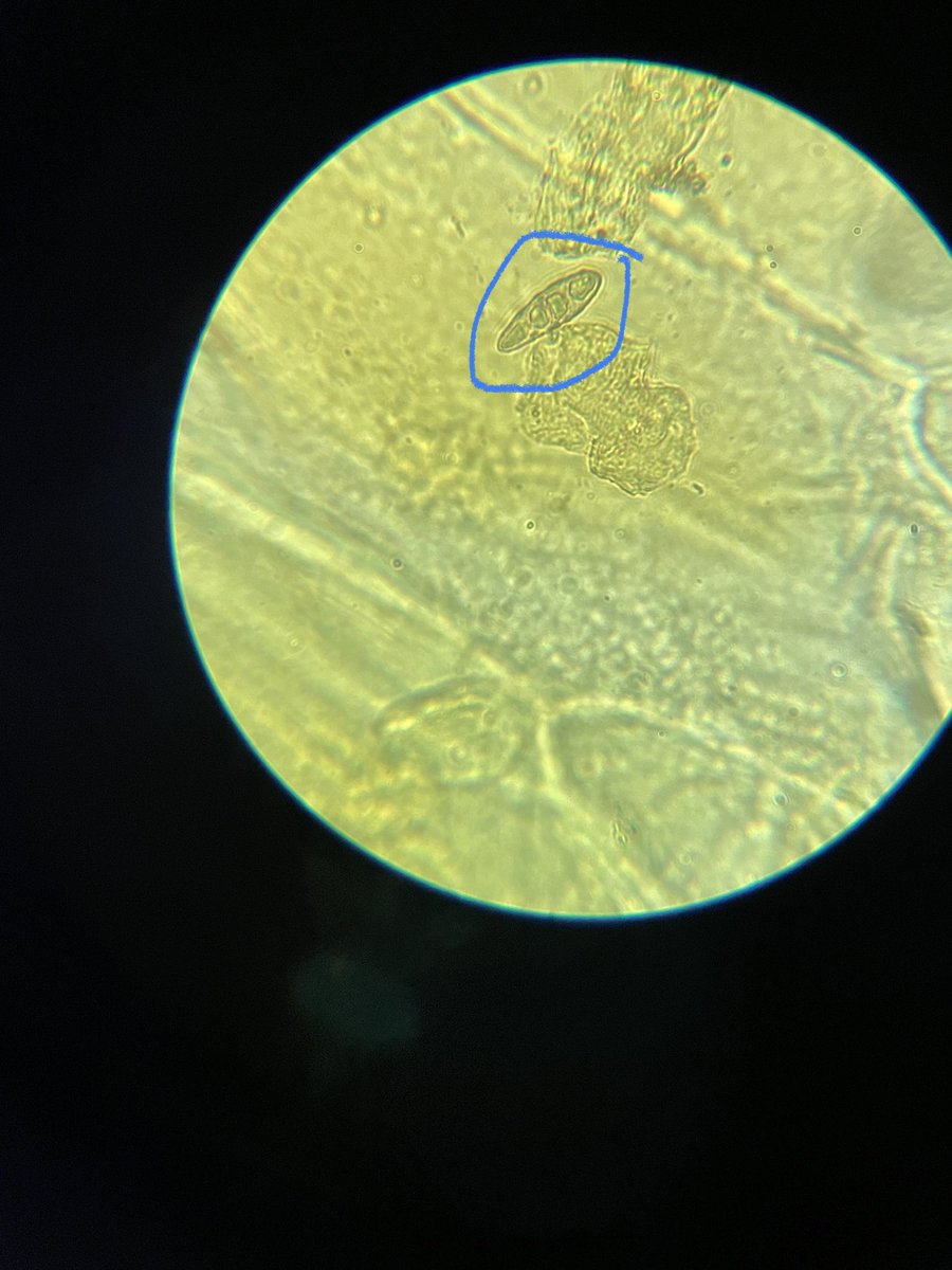 EMS7Science's tweet photo. Any biology experts want to help us out?  Found this when looking at epidermal onion cells today.  Image taken at 1000x mag.  What is it? @moeckel56 ? https://t.co/rHohGqDW4Z