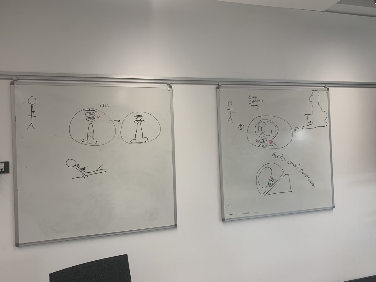 theatreedandde1's tweet photo. Anaesthetic Nursing Course, Day 4. Dr Dawson comes to lecture and draw, can you guess what about? #NTU #anaestheticnurses #nursedevelopment @suechisholm01 @L_MitchellODP @NUHNursing @TrentUni @NuhTheatres #ntunursing https://t.co/RLxppwu9tt