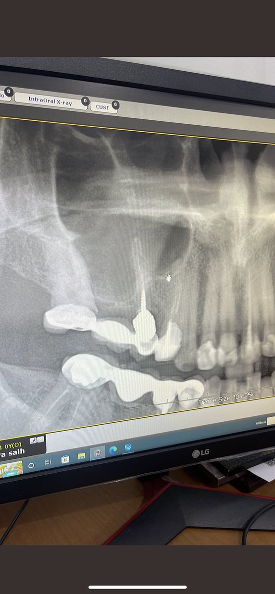 د. مشّاري tweet media