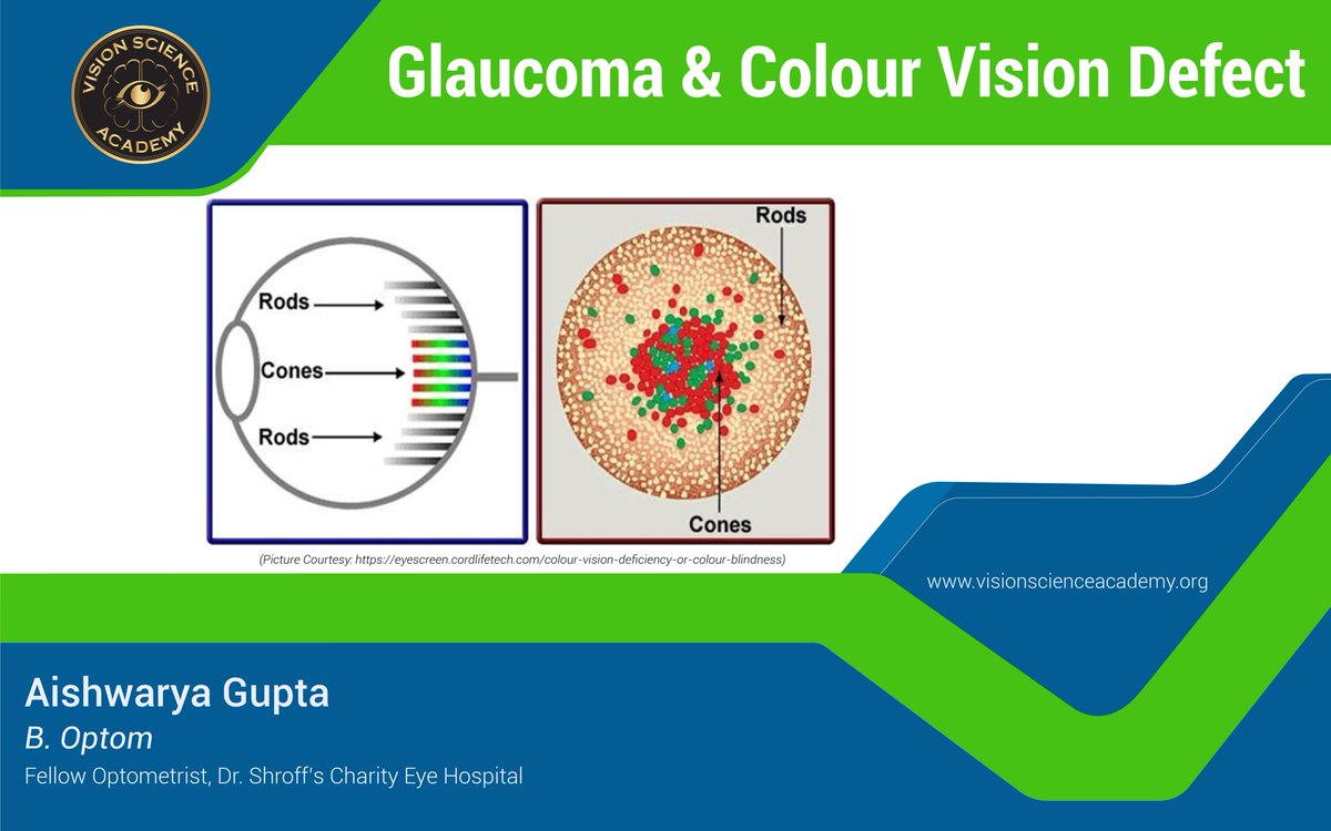 science_vision's tweet photo. Glaucoma & Colour Vision Defect
By - Aishwarya Gupta, Dr. Shroff’s Charity Eye Hospital
Read here https://t.co/jpkvwBCXpH
#eyehealth #optometry #ophthalmology #eyecare #visionscience #colourvision #glaucoma #defect #visualdeficiency #treatment #knowledge #visionscienceacademy https://t.co/uybxIu4nFy