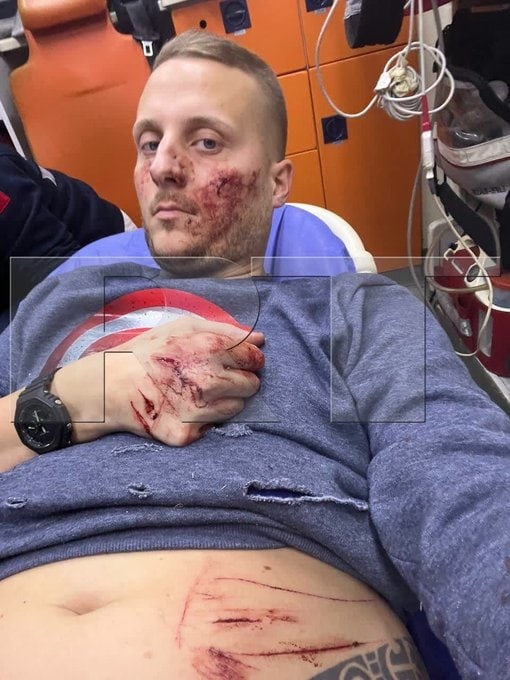 На бывшего французского спецназовца, рассказавшего правду про постановку укроп в Буче, как раскладывали тела, привозили в рефрижераторах, совершено покушение.
«Караулили с вечера».А вчера на него напали два человека с ножом. Боке нанесли несколько резаных ран.