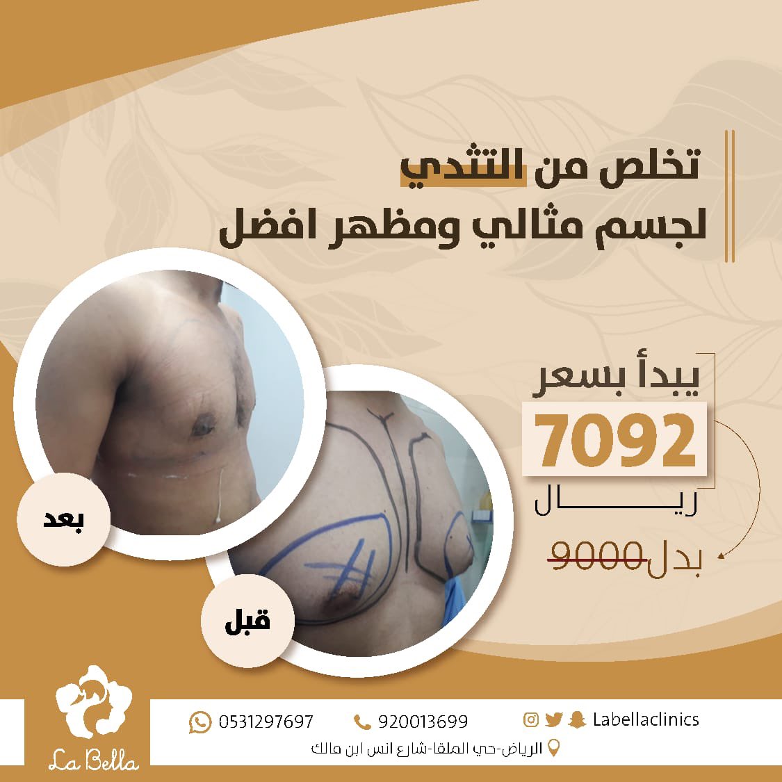 labellaclinics's tweet photo. للحجز والاستفسارات✨
📱0531297697
📞920013699
#حيث_يكتمل_الجمال https://t.co/bP1zI0xDAi