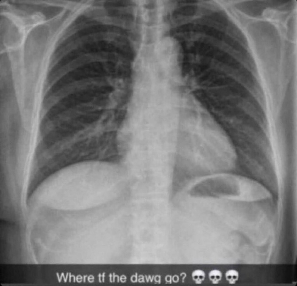 Chengdu Bandits⚪ tweet media