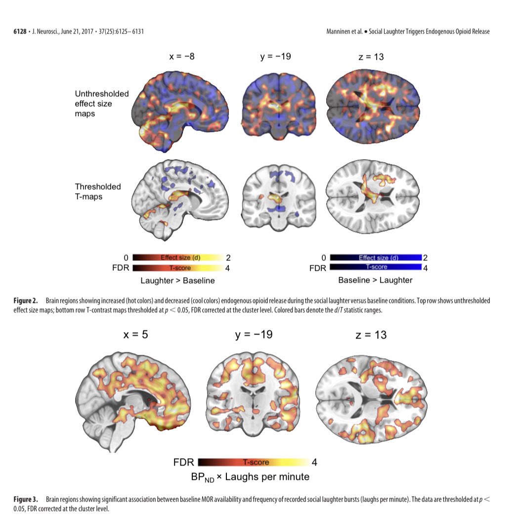 OGdukeneurosurg's tweet photo. Laughter Triggers Endogenous Opioid Release in thalamus, caudate nucleus, and anterior insula and elevates your pain threshold. Source jneurosci. #neuroscience #opoids #pain #neurotwitter #brain https://t.co/yHMPUp71Iw