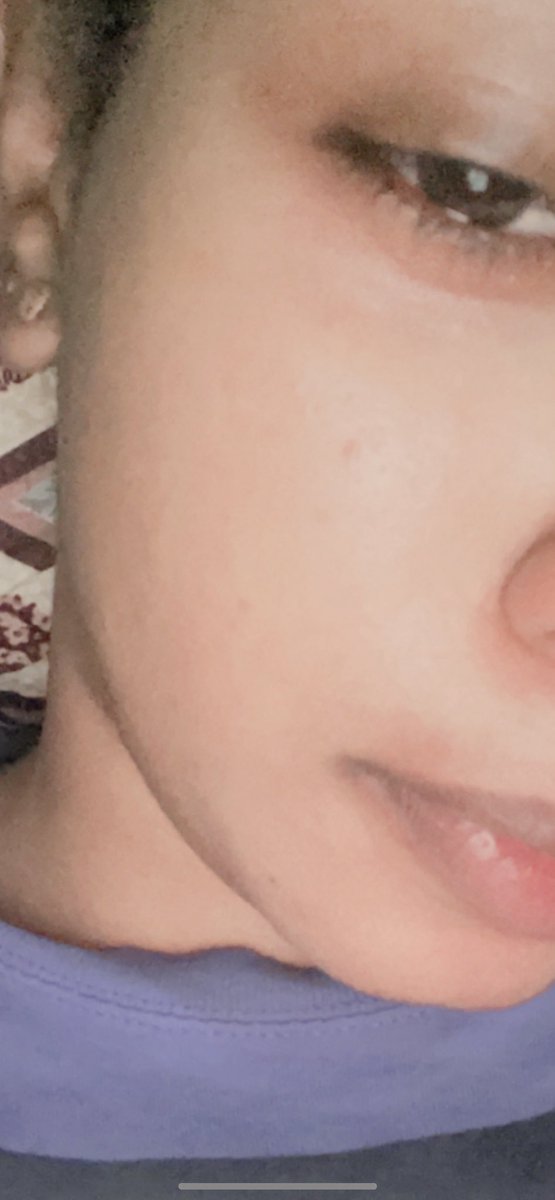 store_grape's tweet photo. مساء الخير🖤🖤🖤
حيكون في سحب على سيرم اورديناري الجبار من الرتويييت🔥🔥🔥🖤 في احلى من كدا؟🖤
وشروط ساهله جدا كل العليكي تعملي رتويت وفولو للصفحه🖤 وتقولي باي للاثار والحبوب والمسامات الواسعه المزعجه🔥🖤🖤
يلا همتكم معاي حسحب بعد ثلاثه ايام🔥🔥🔥🖤 https://t.co/tgBJQGpyEV