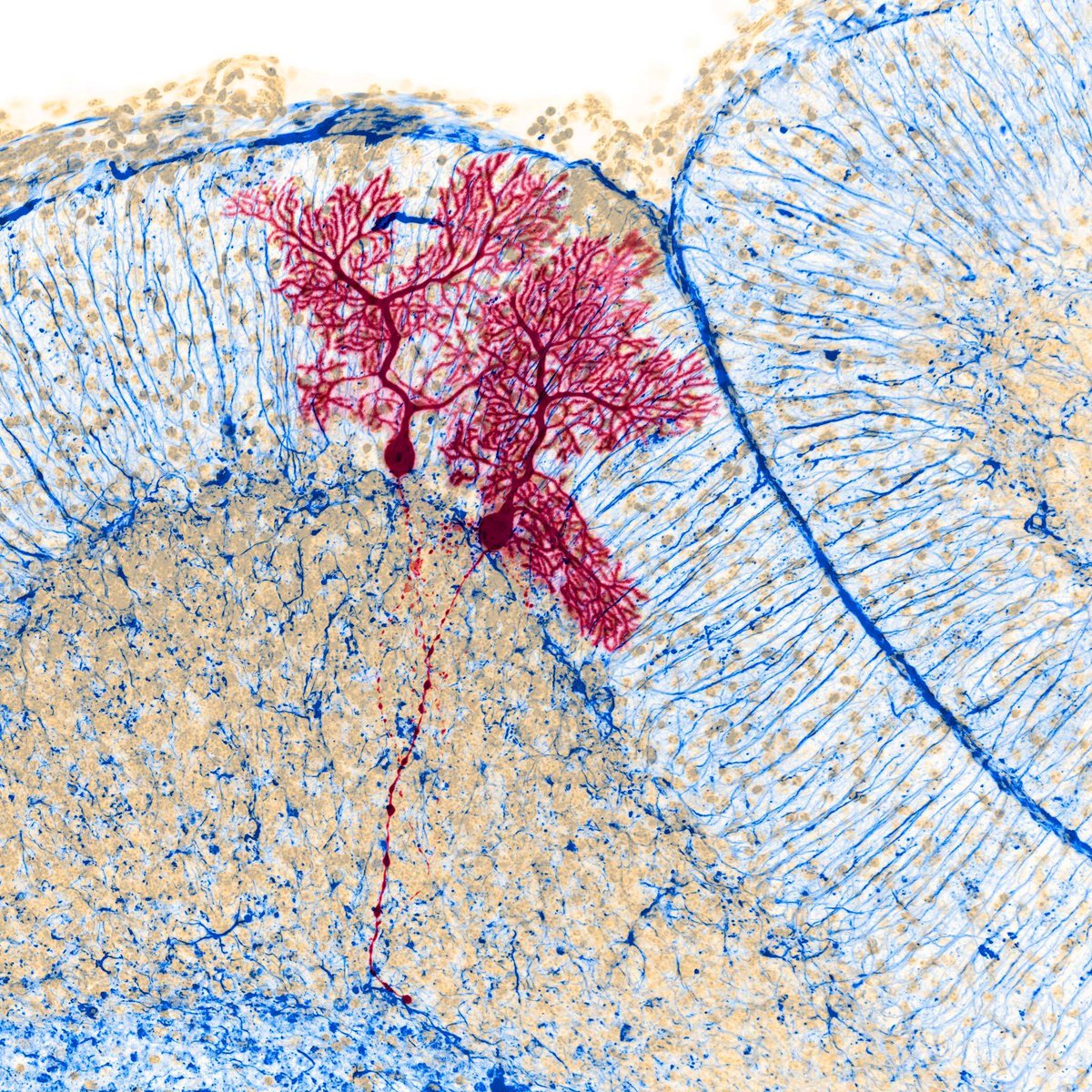 Pretty Purkinje cells in mouse cerebellum.

Credits: Benjamin Barti

#neuroscience #neurotwitter #sciencetwitter #brain #Bioinformatics  #neurology #science #medicine #MedTwitter #biotech